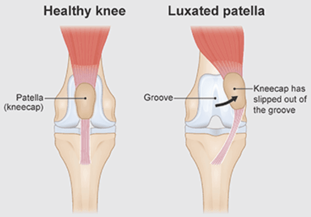 Diagram of patellar luxation in dogs